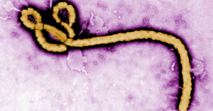 Ebola is the most current widespread virus originated from Africa and spreading to many different parts of the world like America. People in the states even New York have been getting infected by the deadly virus, but state officials claimed that it isn't air born and people have no need to worry. Picture from public domain.